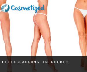 Fettabsaugung in Quebec
