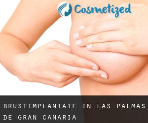 Brustimplantate in Las Palmas de Gran Canaria
