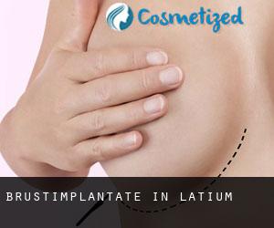 Brustimplantate in Latium