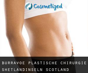 Burravoe plastische chirurgie (Shetlandinseln, Scotland)