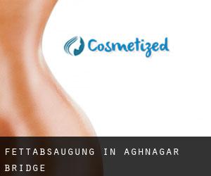 Fettabsaugung in Aghnagar Bridge