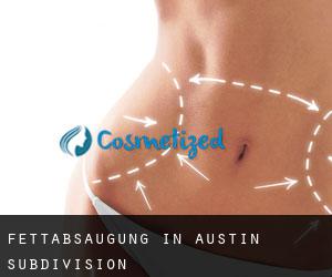 Fettabsaugung in Austin Subdivision