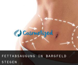 Fettabsaugung in Bargfeld-Stegen