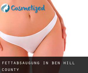 Fettabsaugung in Ben Hill County