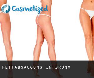 Fettabsaugung in Bronx