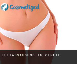 Fettabsaugung in Cereté Fettabsaugung in Cereté