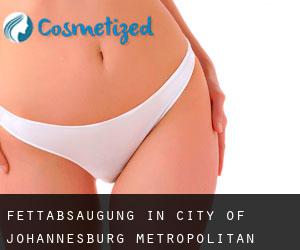 Fettabsaugung in City of Johannesburg Metropolitan Municipality durch gemeinde - Seite 2