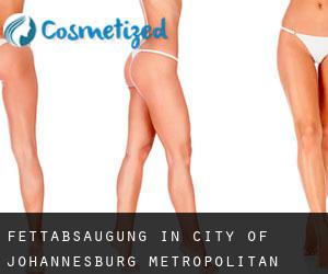 Fettabsaugung in City of Johannesburg Metropolitan Municipality durch hauptstadt - Seite 1