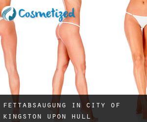 Fettabsaugung in City of Kingston upon Hull