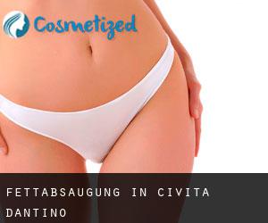Fettabsaugung in Civita d'Antino