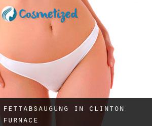 Fettabsaugung in Clinton Furnace