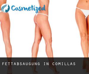 Fettabsaugung in Comillas
