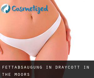 Fettabsaugung in Draycott in the Moors