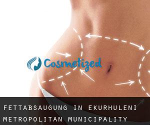 Fettabsaugung in Ekurhuleni Metropolitan Municipality Fettabsaugung in Ekurhuleni Metropolitan Municipality
