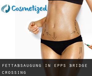 Fettabsaugung in Epps Bridge Crossing