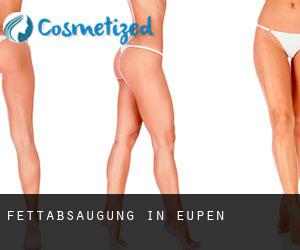 Fettabsaugung in Eupen