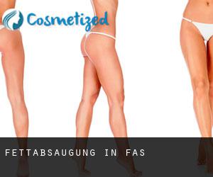 Fettabsaugung in Fasā Fettabsaugung in Fasā