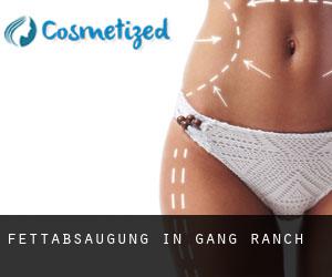 Fettabsaugung in Gang Ranch