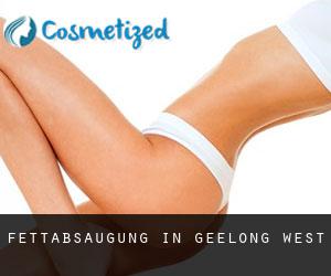 Fettabsaugung in Geelong West