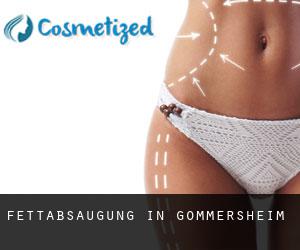 Fettabsaugung in Gommersheim