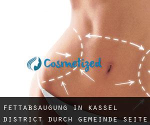 Fettabsaugung in Kassel District durch gemeinde - Seite 1