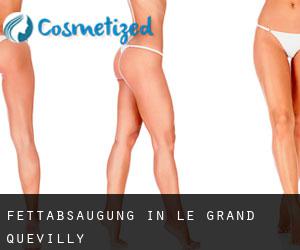 Fettabsaugung in Le Grand-Quevilly