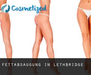 Fettabsaugung in Lethbridge Fettabsaugung in Lethbridge