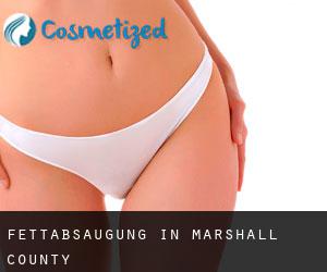 Fettabsaugung in Marshall County