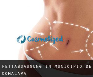 Fettabsaugung in Municipio de Comalapa