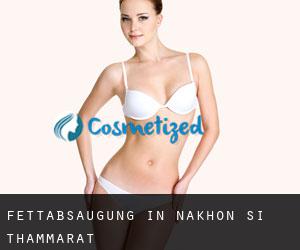 Fettabsaugung in Nakhon Si Thammarat Fettabsaugung in Nakhon Si Thammarat