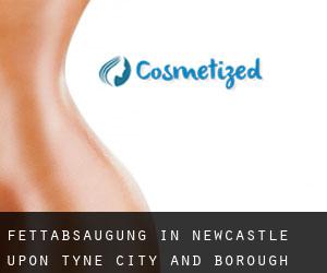 Fettabsaugung in Newcastle upon Tyne (City and Borough)