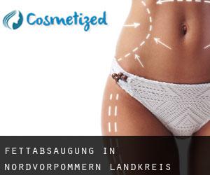 Fettabsaugung in Nordvorpommern Landkreis Fettabsaugung in Nordvorpommern Landkreis