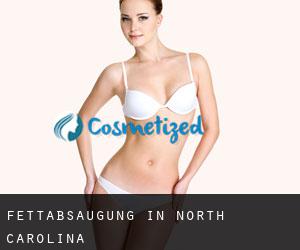 Fettabsaugung in North Carolina Fettabsaugung in North Carolina