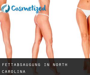 Fettabsaugung in North Carolina