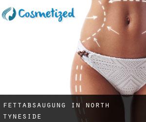 Fettabsaugung in North Tyneside Fettabsaugung in North Tyneside
