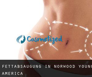 Fettabsaugung in Norwood Young America