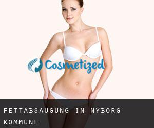 Fettabsaugung in Nyborg Kommune Fettabsaugung in Nyborg Kommune