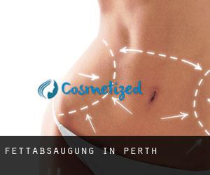 Fettabsaugung in Perth