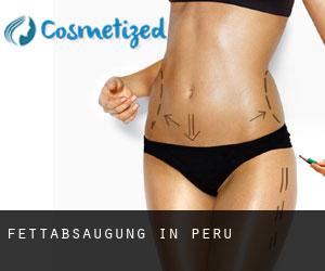 Fettabsaugung in Peru