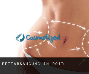 Fettabsaugung in Poid Fettabsaugung in Poid