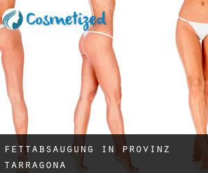 Fettabsaugung in Provinz Tarragona