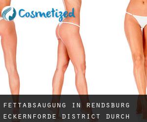 Fettabsaugung in Rendsburg-Eckernförde District durch testen besiedelten gebiet - Seite 4