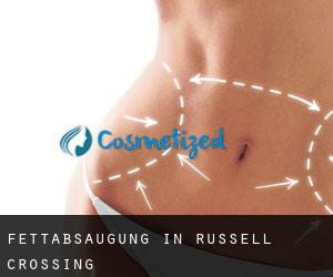 Fettabsaugung in Russell Crossing