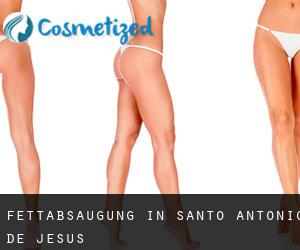 Fettabsaugung in Santo Antônio de Jesus