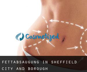 Fettabsaugung in Sheffield (City and Borough)