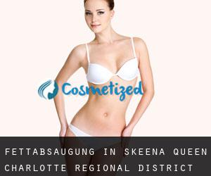 Fettabsaugung in Skeena-Queen Charlotte Regional District