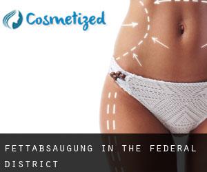 Fettabsaugung in The Federal District