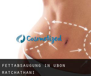 Fettabsaugung in Ubon Ratchathani