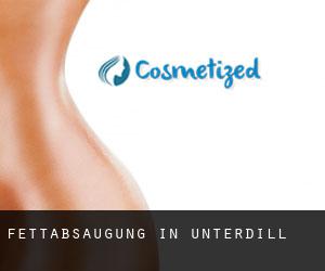 Fettabsaugung in Unterdill Fettabsaugung in Unterdill