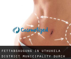 Fettabsaugung in uThukela District Municipality durch stadt - Seite 1